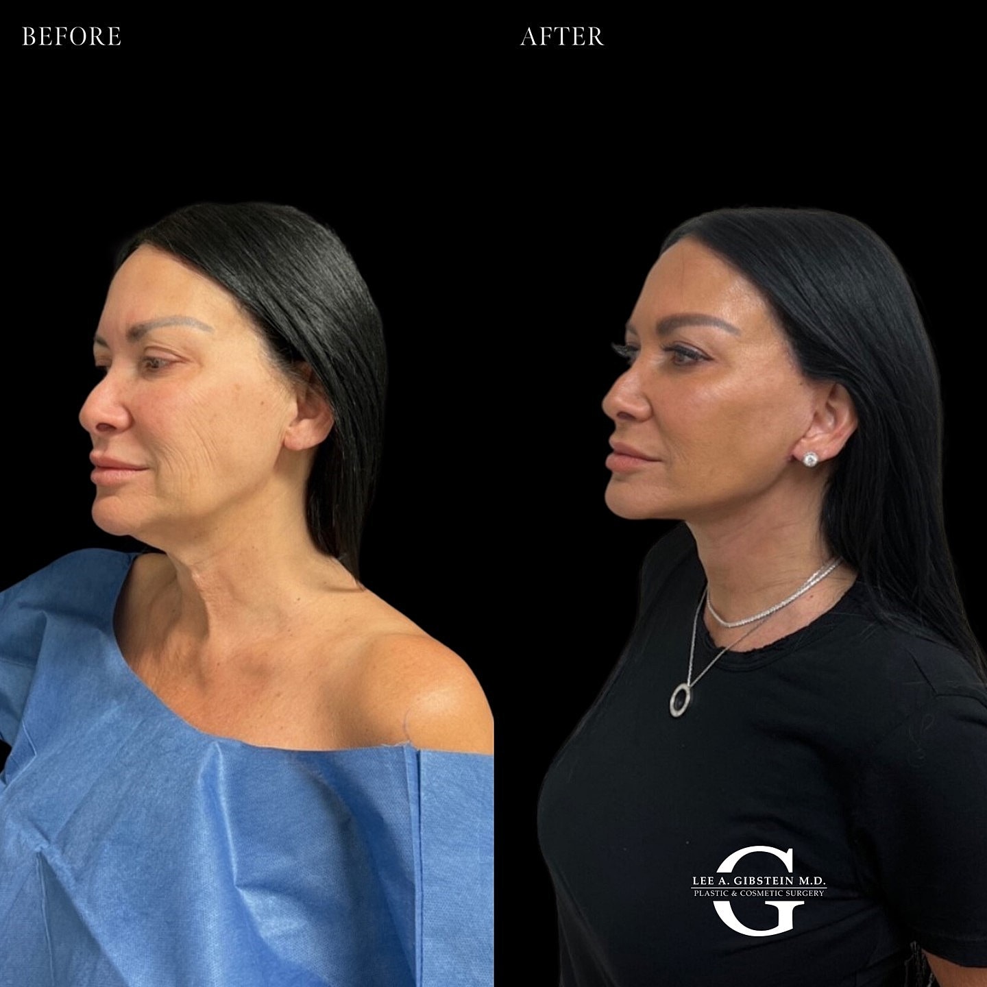 Facial transformation before and after treatment.