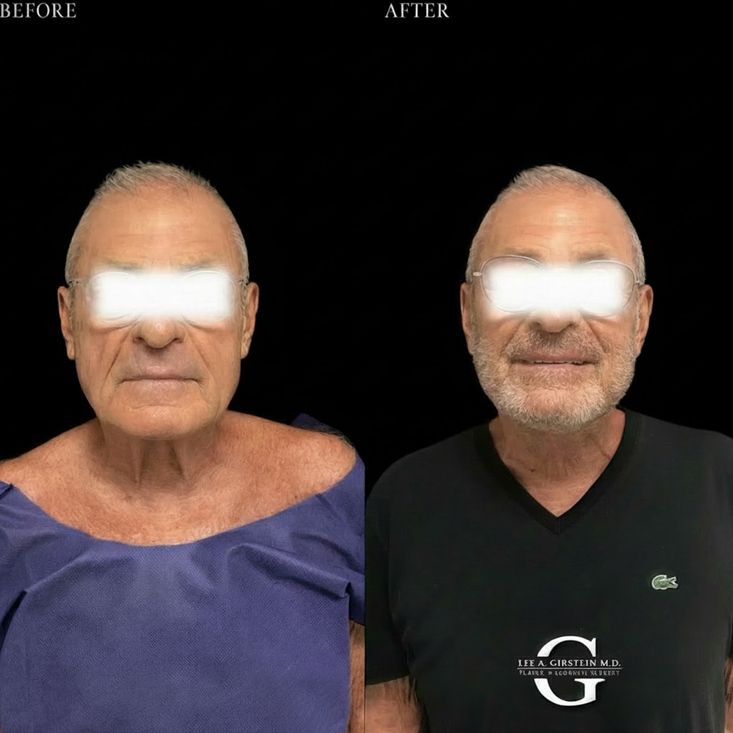Before and after transformation of an older man.